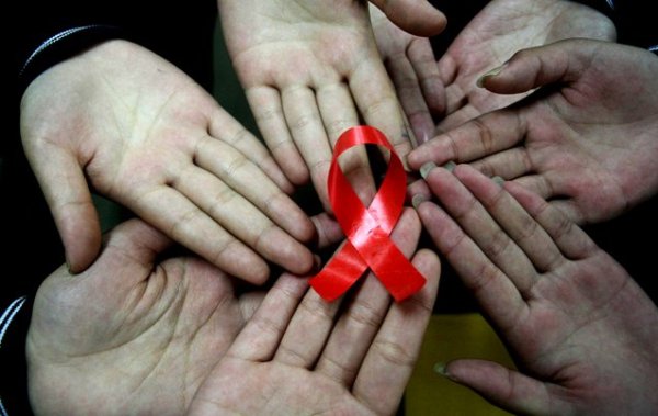 linfonodi-hiv-aids